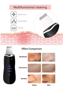 موجات فوق الصوتية منظف لإزالة الرؤوس السوداء منظف بشرة الوجه